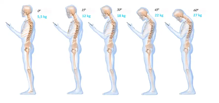 representacion del peso de la cabeza mirando el movil y su dolor de cuello